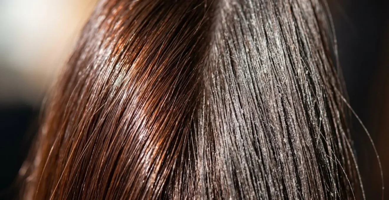 Vue macro d'une mèche de cheveux montrant l'accumulation de résidus